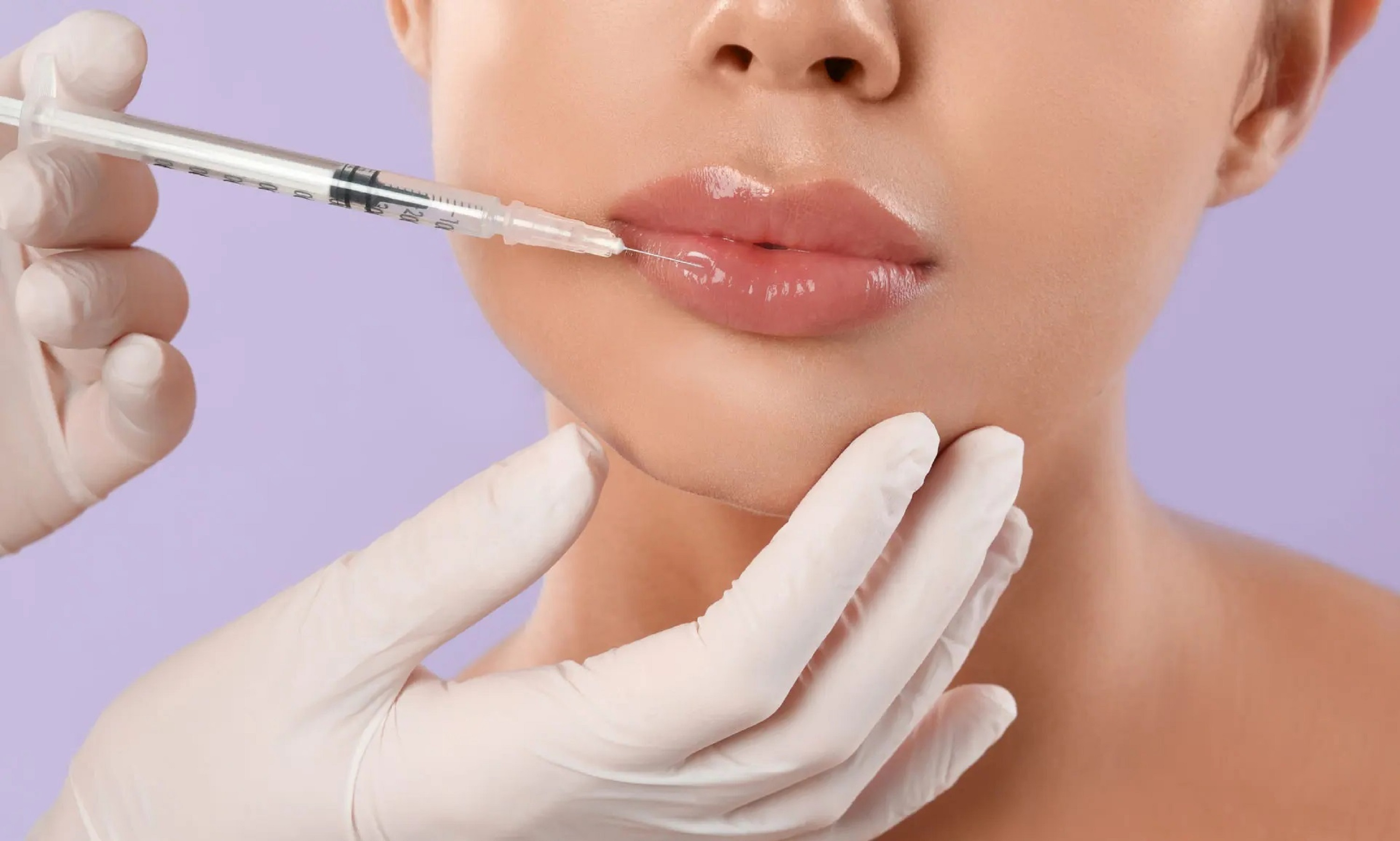 Dermal Filler